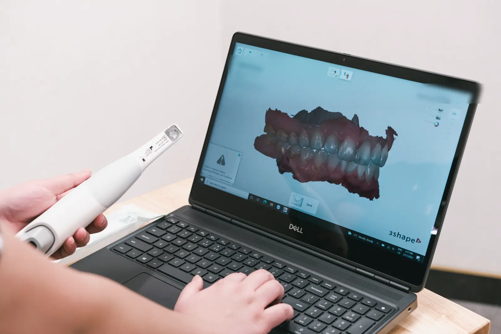 Dr. Kat holding the intraoral scanner beside a 3D scan of teeth on a laptop