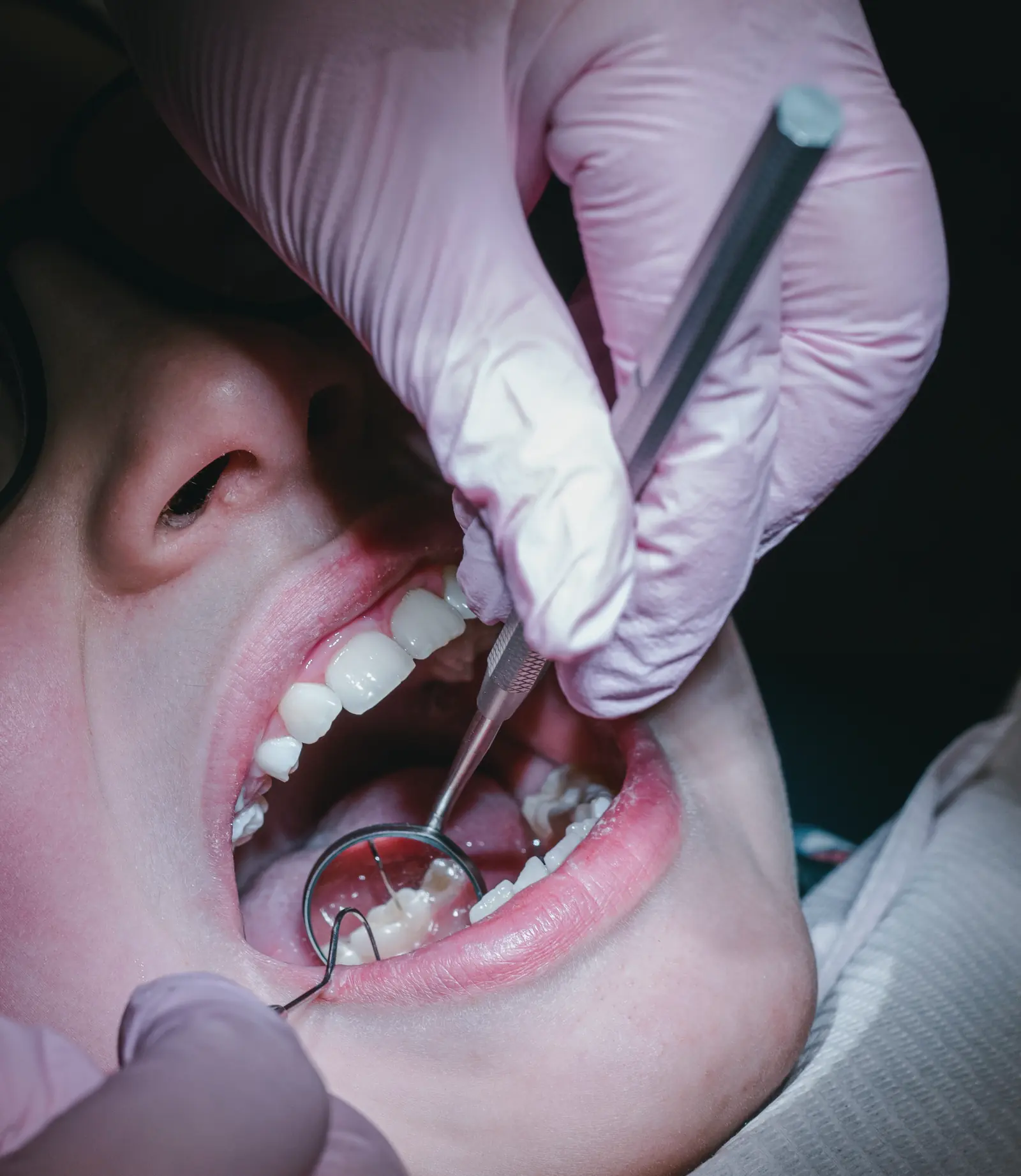 Dr. Katherina Nguyen, DDS, checking a patient's teeth with a mouth mirror and explorer